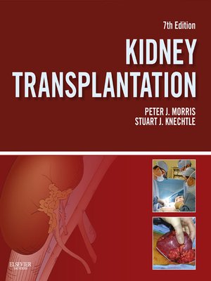 cover image of Kidney Transplantation--Principles and Practice E-Book